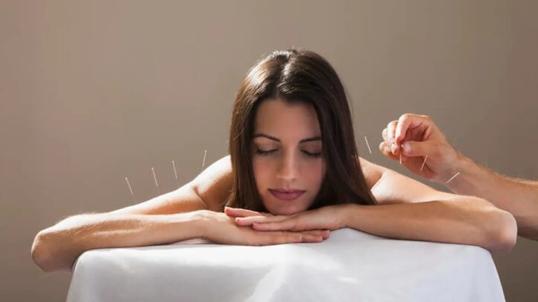 Is Acupuncture A Natural Facelift?