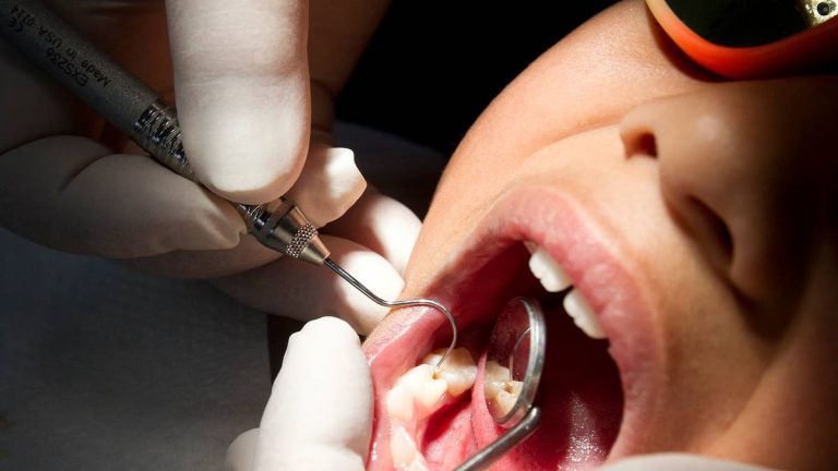 Lakes Children Face Long Waits For Dental Work, 'complex Problem'