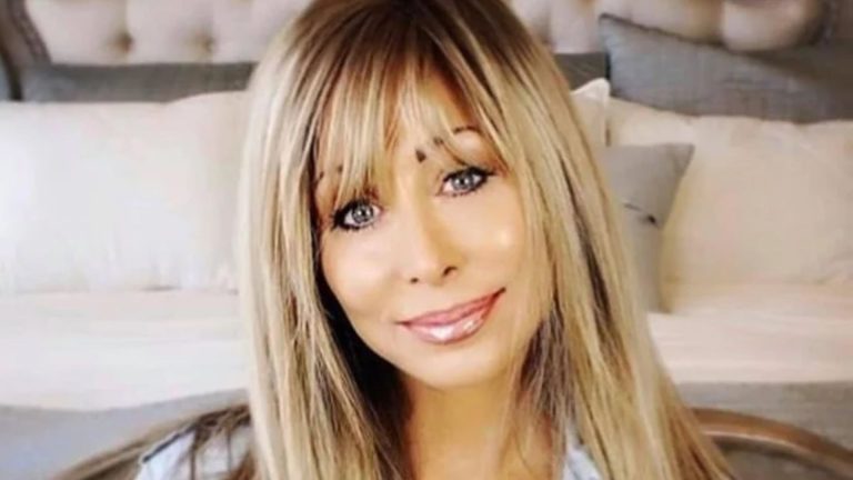 Mom Dies Of Brain Damage After Veneers Go Wrong At