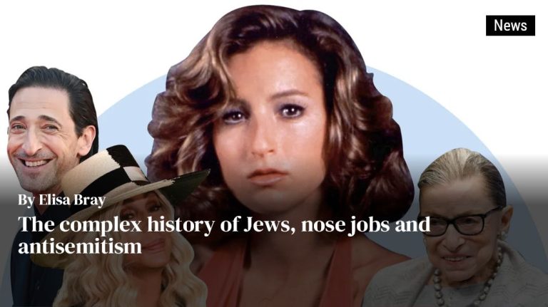 The Complicated History Of Jews, Nose Jobs And Anti Semitism