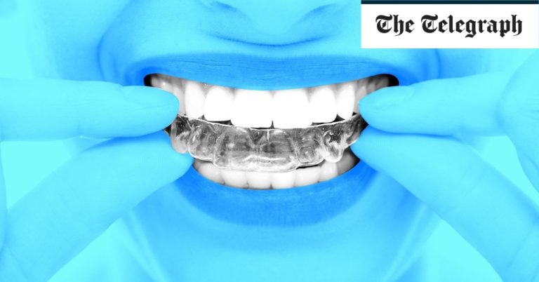 How Wearing Braces In Middle Age Became All The Rage