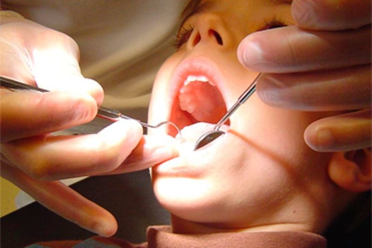 Ni Dental Crisis: Stormont Deadlock To Add To Problems As