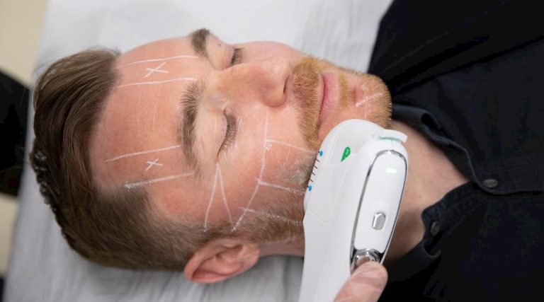 The Ultimate Non Invasive Alternative To Men's Skin Tightening