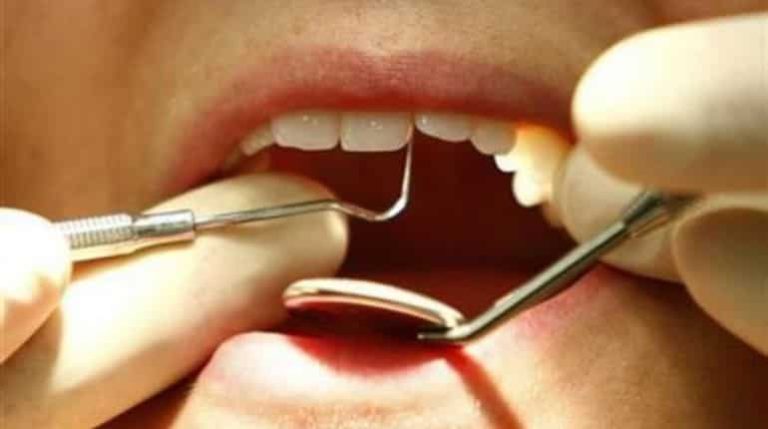 Us Patient Sues Dentist Who Performed 20+ Procedures In One