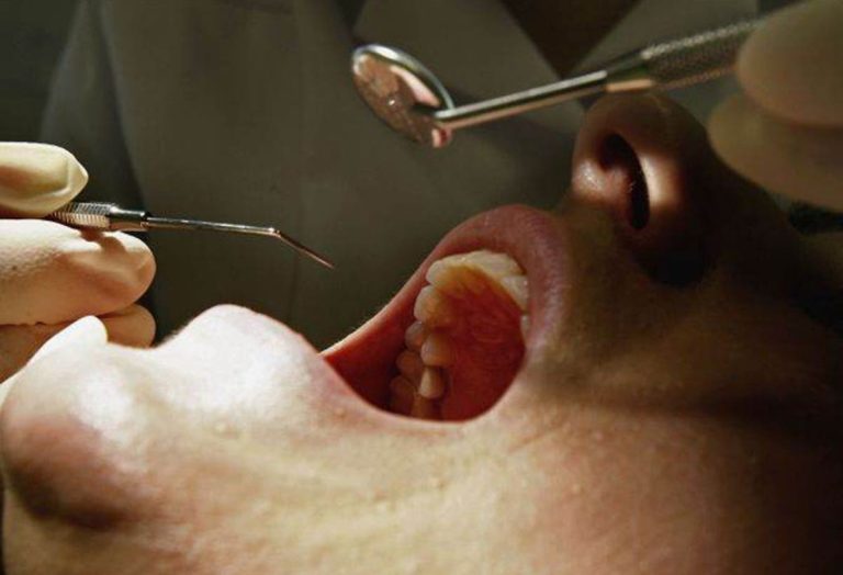 Dental Patients At Risk From Banned Fake Gold Implants |