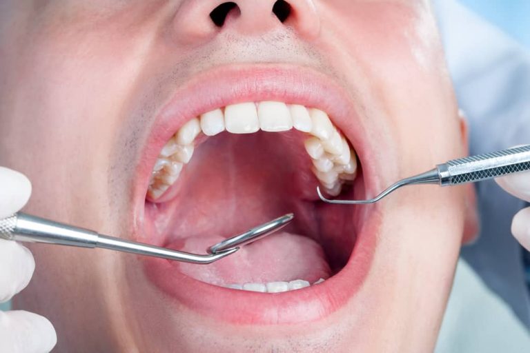 Diabetes, Gum Disease And Other Dental Problems