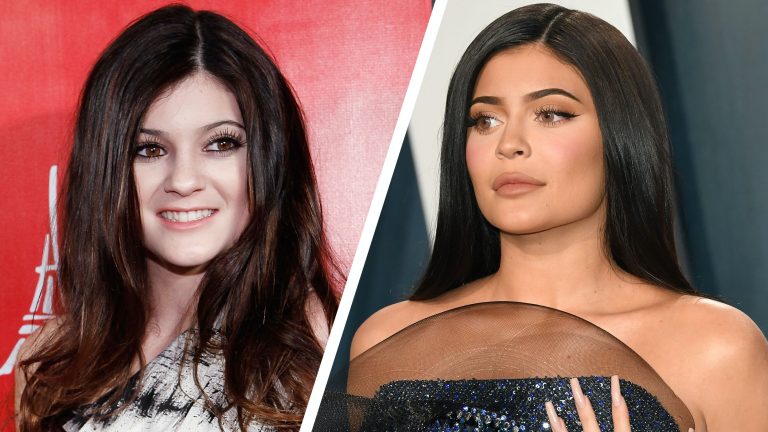 Kylie Jenner Before And After: The Stunning Photos Of Her
