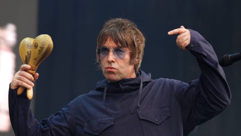 Liam Gallagher Says He Would Get A Hair Transplant "on