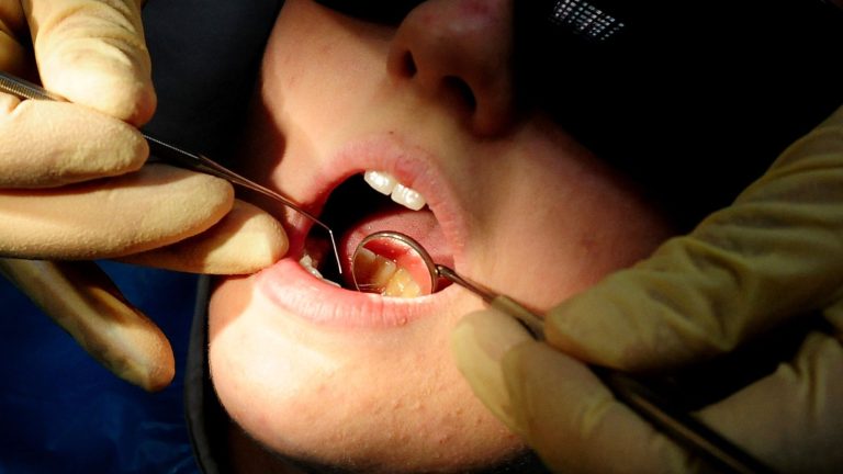 Nhs Dental 'rehabilitation Plan' A 'temporary Filler' Says Cumbrian Mp