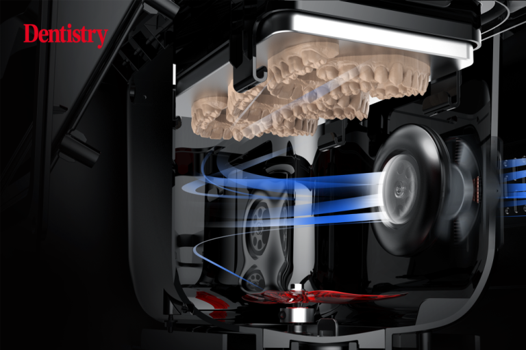 Revolutionize Dental Restorations With Sprintray