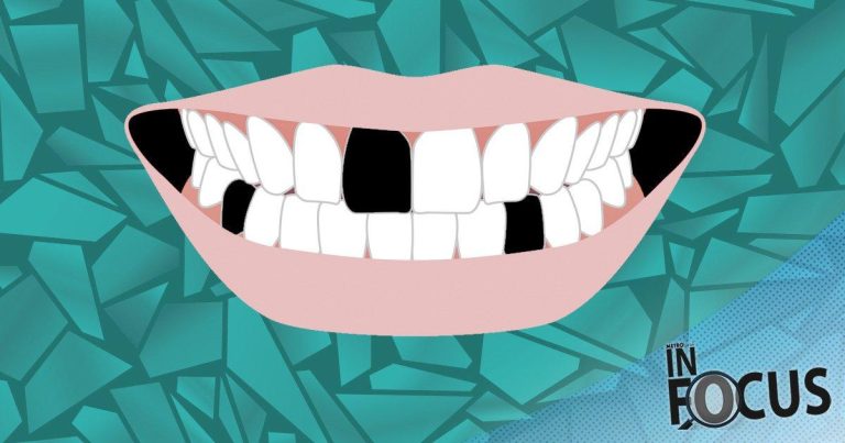 The Rise Of Diy Dentistry: 'i Pulled Five Of My