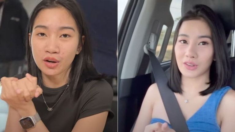 Vien Iligan Reveals Amazing Transformation After Rhinoplasty And Chin Augmentation