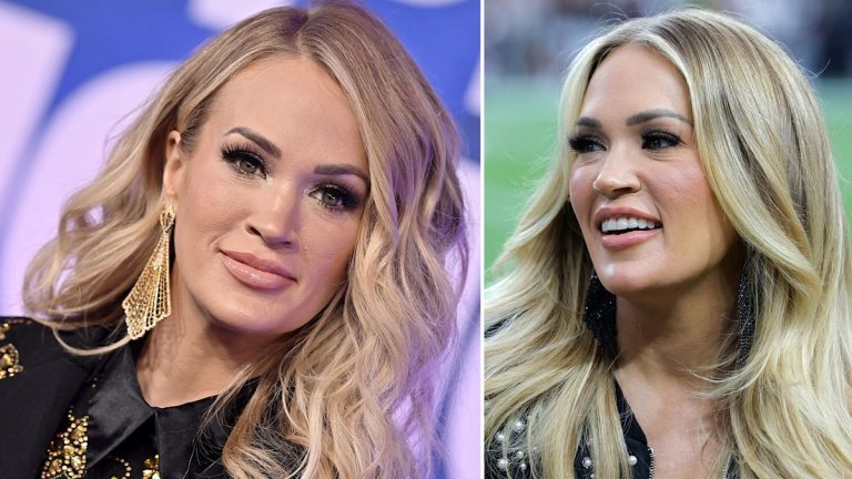 Carrie Underwood Plastic Surgery: What Had She Done?