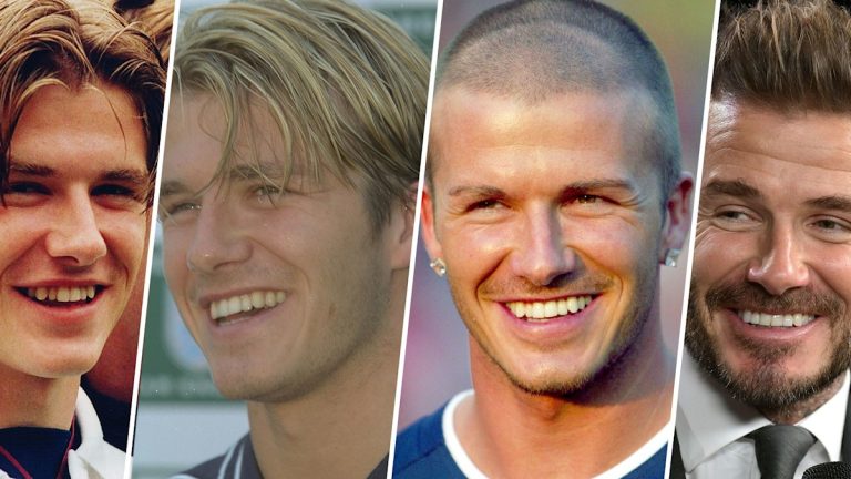 David Beckham's Smile Makeover: Before And After Photos