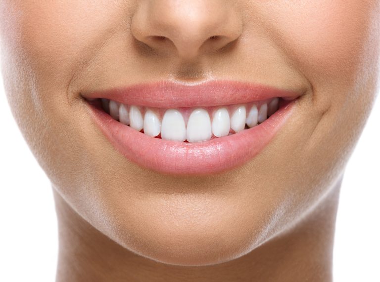 Dentist Reveals What To Do Instead Of 'harmful' Teeth Whitening