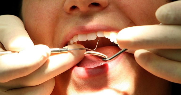 Eu Ban On Tooth Sealants Will Lead To 'collapse Of