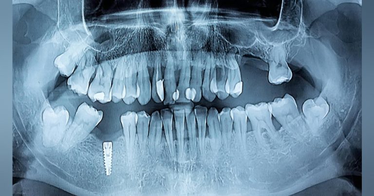 Game Changers In Dentistry And Oral Medicine: From Rapid Diagnosis