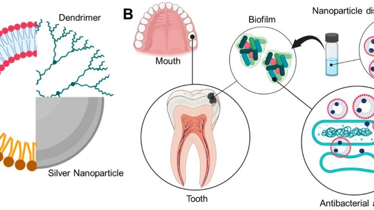 New Study Validates Effectiveness Of Ion Releasing Investments In Tooth Decay