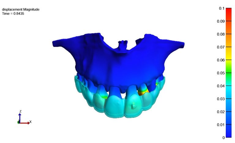 Teeth Straightening? Ai Can Help