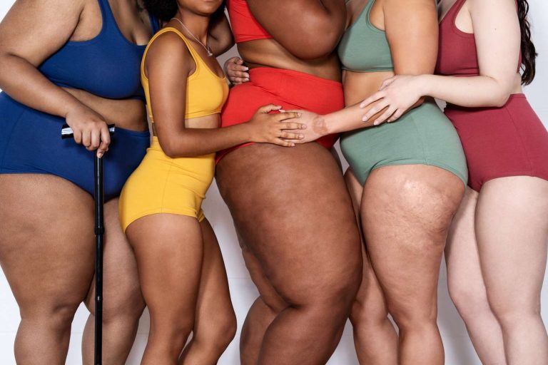 What Is Cellulite? The Science Behind Cellulite