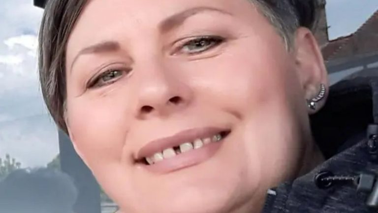 Woman, 56, Wins £40,000 After Dentist 'ruined Her Smile And