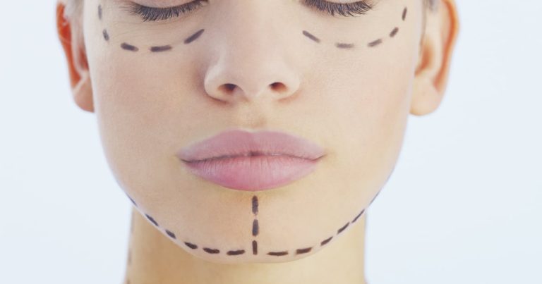 What You Need To Know About Chin Augmentation, From A