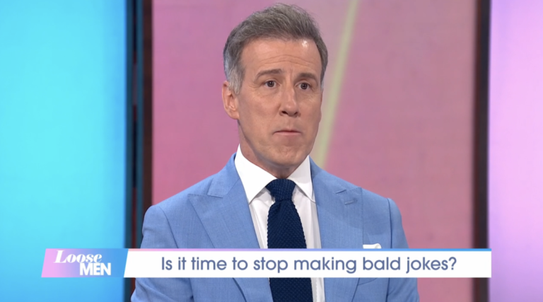 Anton Du Beke Reveals Why He Had A Hair Transplant