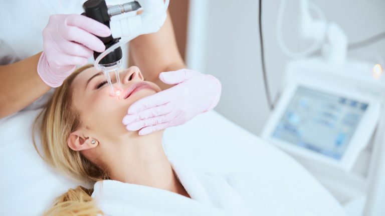 Fractional Co2 Laser Treatment For Acne Scars: Expert Explains The