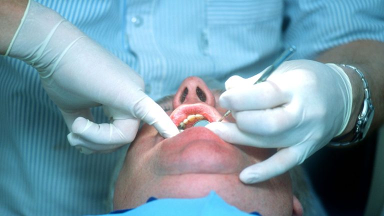 Amalgam Fillings Ban Averted In Northern Ireland After Eu Opt Out