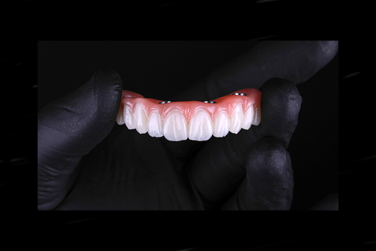 Flexcera Smile Ultra+ Resin Is Revolutionizing 3d Printed Dental Restorations