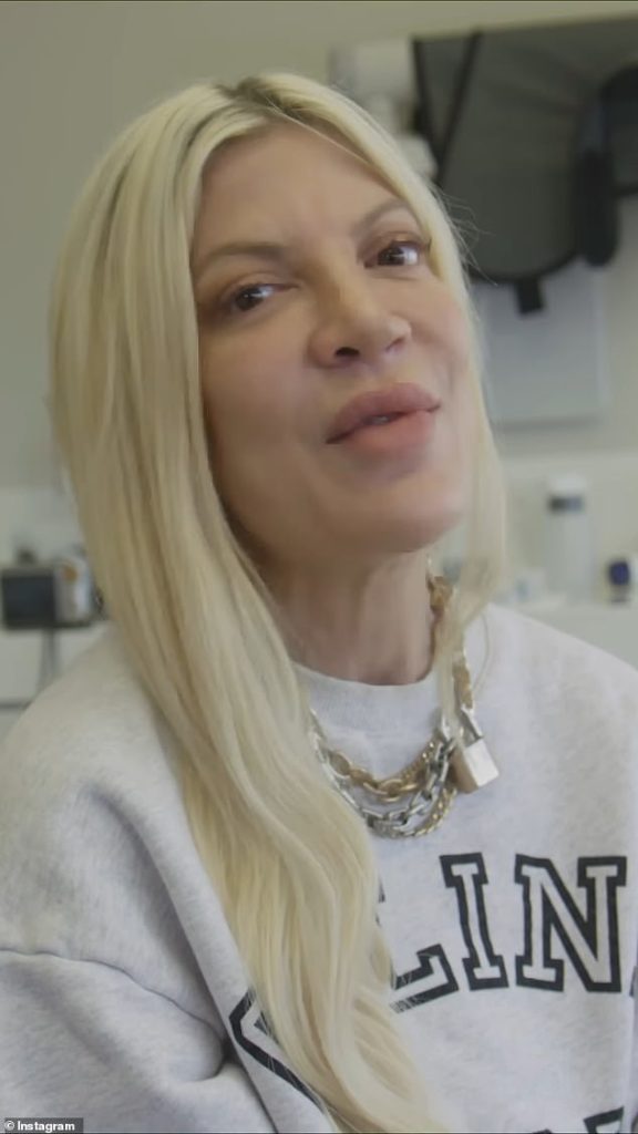 Tori Spelling Gives Fans An Inside Look At Her Veneer