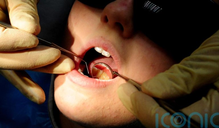 A Ban On Amalgam Fillings In Northern Ireland Was Averted