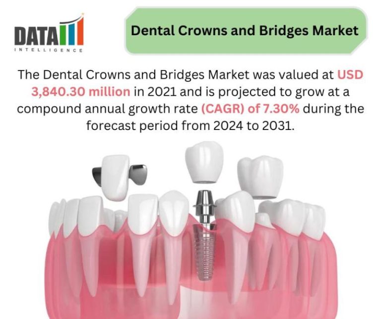 Dental Crowns And Bridges Market To Grow Rapidly By 2031