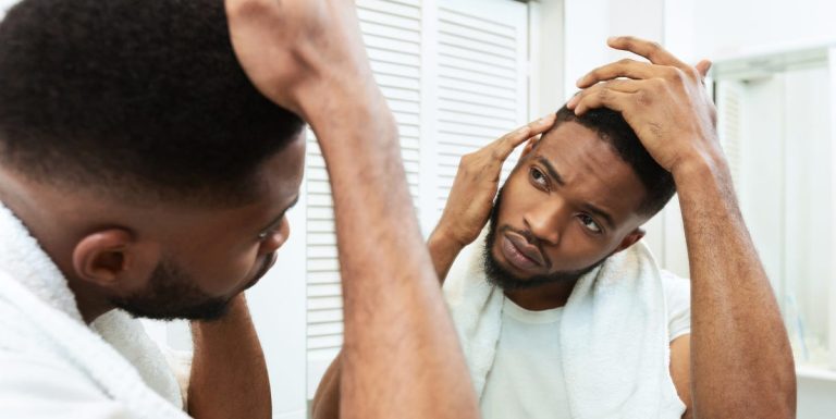 Is There A Cure For Baldness? Here's What Science Says