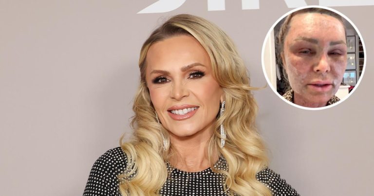 Rhoc's Tamra Judge Says Plastic Surgery 'isn't Always Worth It'