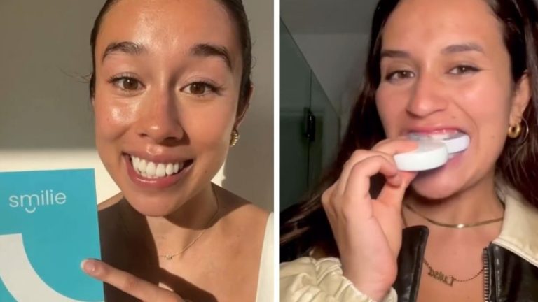 Smilie Teeth Whitening Review: We Test Diy 'miracle' Kits