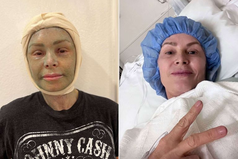 Tamra Judge Shows Off Plastic Surgery: 'i've Never Felt More