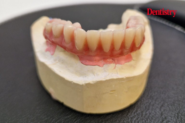 The "all In Four" Mandibular Restoration Concept