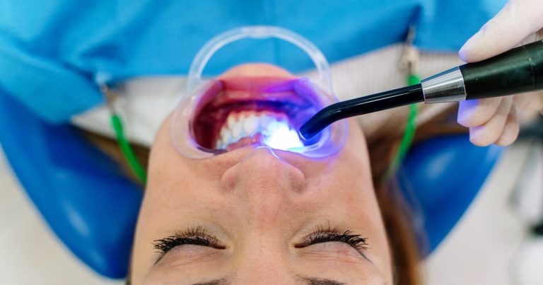 The Dangers Of Teeth Whitening Without A License: What To