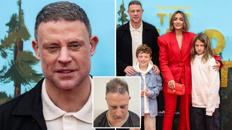 Former Chelsea And England Star Wayne Bridge Shows Full Head