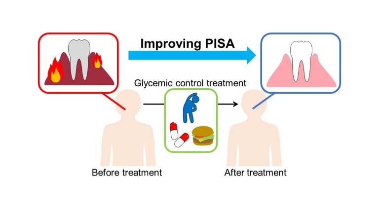 Research Reveals That Intensive Diabetes Treatment Can Reduce The Inflammation