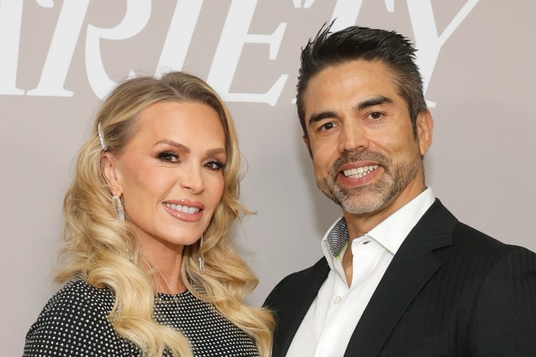 Tamra Judge And Eddie Judge Reveal Their New Veneers