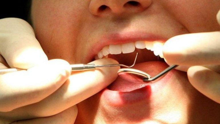 Welsh Dentistry 'unparalleled' In England