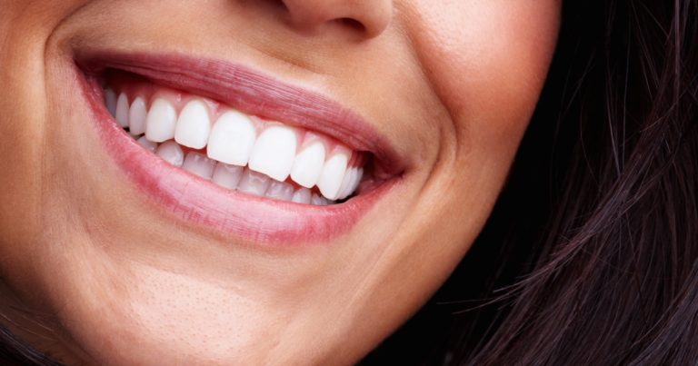 Which Teeth Whitening Products Work And Which Are A Waste