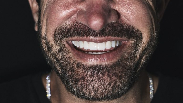 Why Is Everyone In Hollywood Wearing Veneers Now?