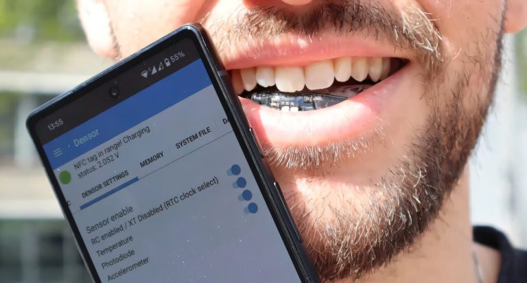 Battery Free Dental Brace Reveals Critical Health Data Via Smartphone