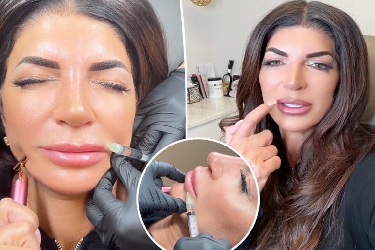 Teresa Giudice Reveals She's Dissolving Her Lip Filler