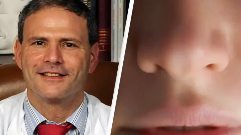 Prominent Plastic Surgeon Suspended After Turning Patients' Noses Into 'potatoes'