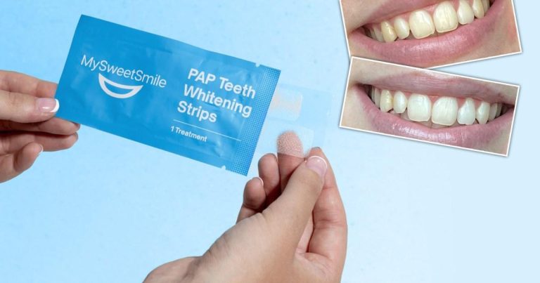 These Fast Acting Teeth Whitening Strips Are Now 25% Off.