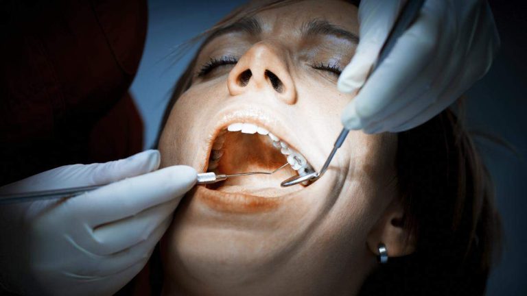 Dental Amalgam Has Been Banned Since January